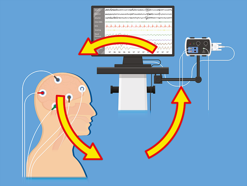 Wirkprinzipt von Biofeedback