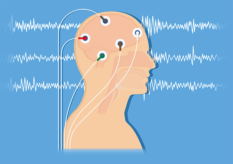 Ableitung von Neurofeedback