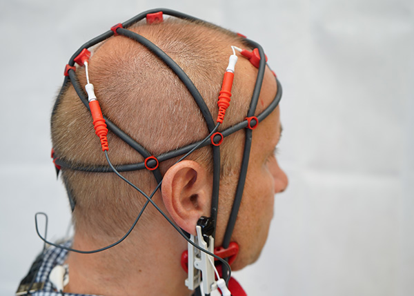 Neurofeedback