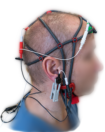 Ableitung von Neurofeedback